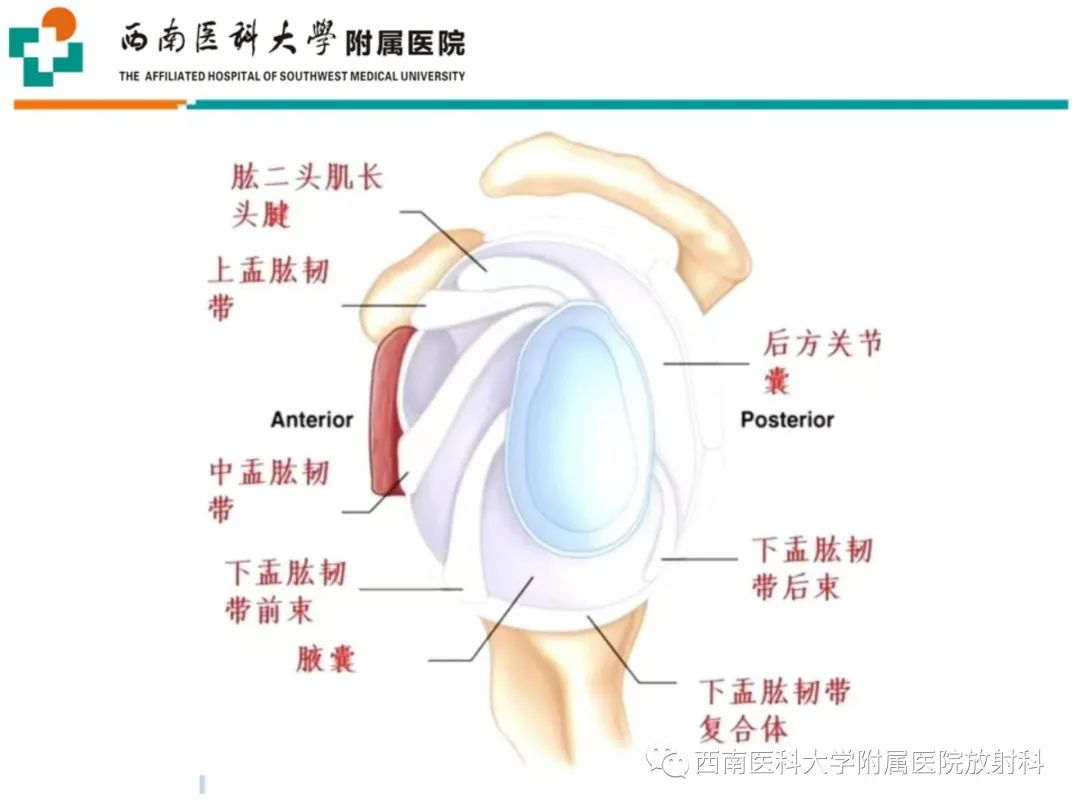 影像PPT - 【PPT】粘连性肩关节囊炎-16