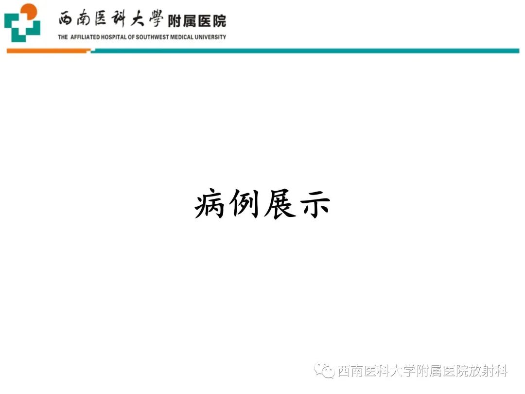影像PPT - 【PPT】粘连性肩关节囊炎-20