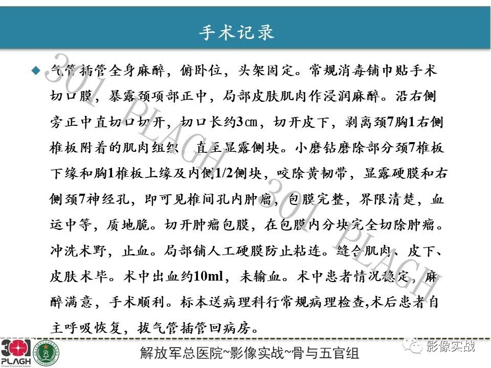 影像PPT - 【病例】颈椎脊索瘤1例MR影像-11