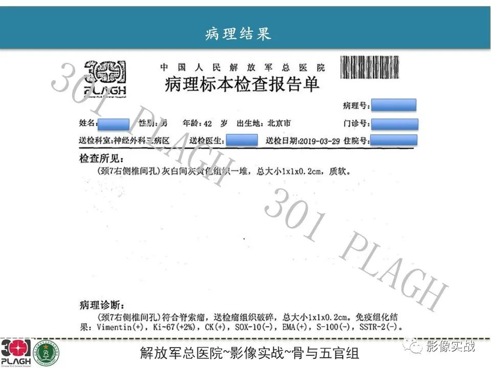 影像PPT - 【病例】颈椎脊索瘤1例MR影像-12