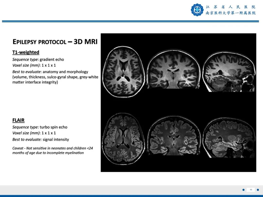 影像PPT - 【PPT】​海马硬化-14