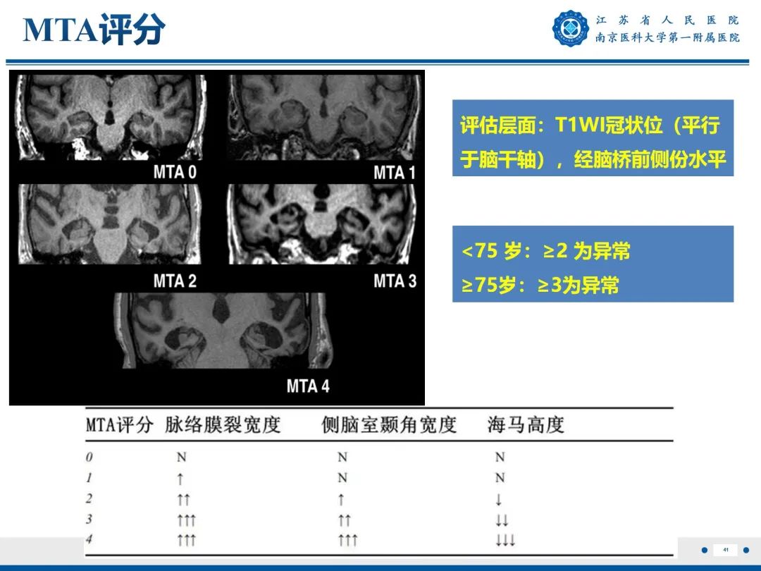 影像PPT - 【PPT】​海马硬化-42