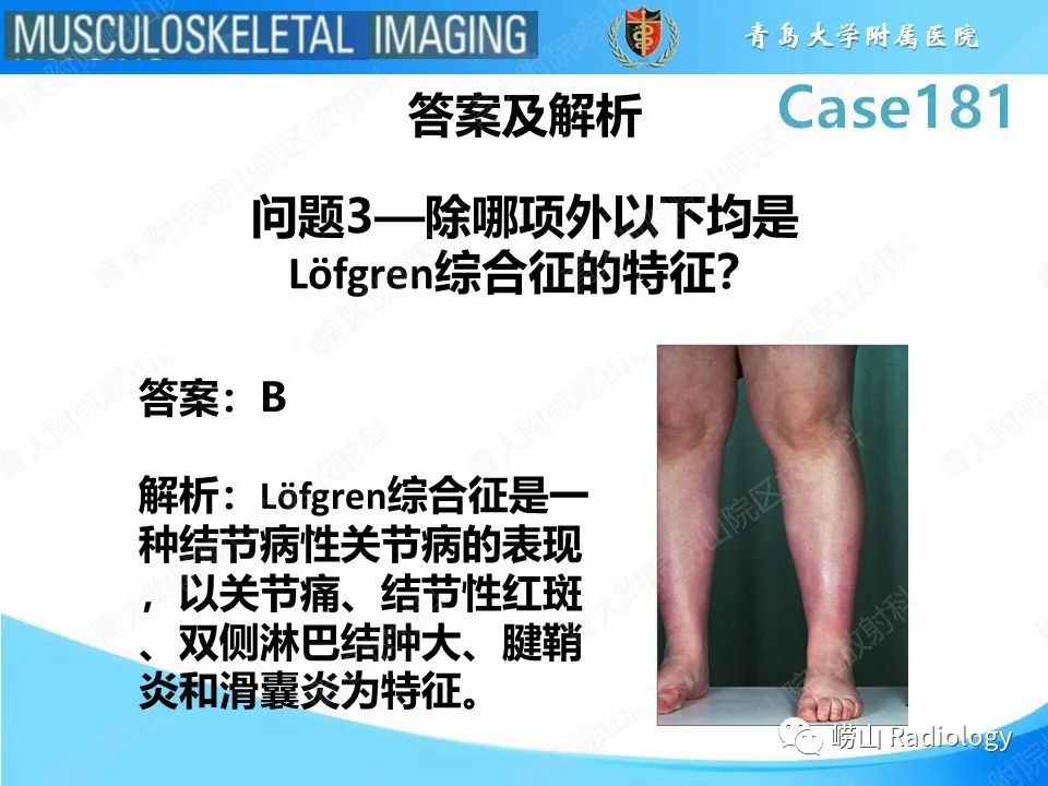 影像PPT - 【PPT】结节病性关节病-8