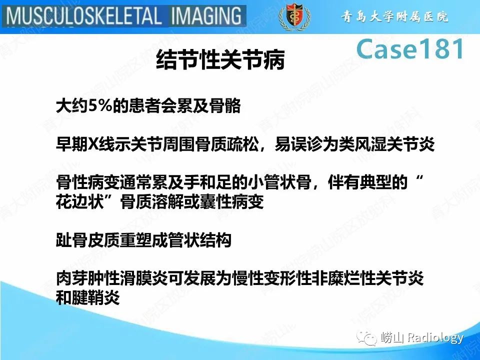 影像PPT - 【PPT】结节病性关节病-12