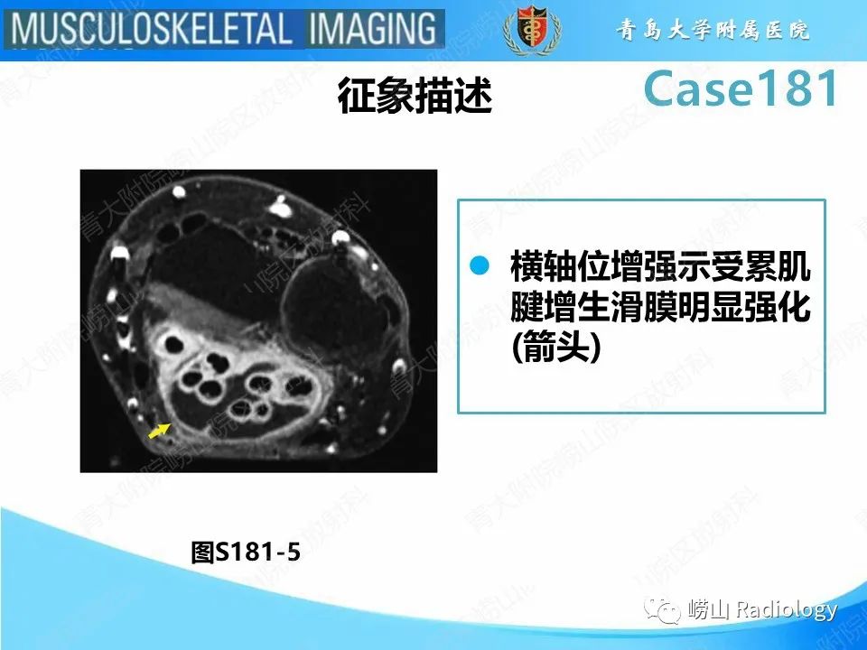 影像PPT - 【PPT】结节病性关节病-18