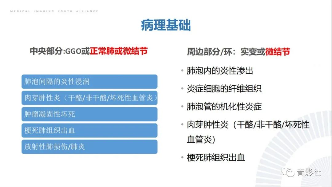 影像PPT - 【PPT】肺部反晕征影像诊断思维-8