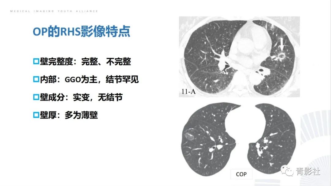 影像PPT - 【PPT】肺部反晕征影像诊断思维-16