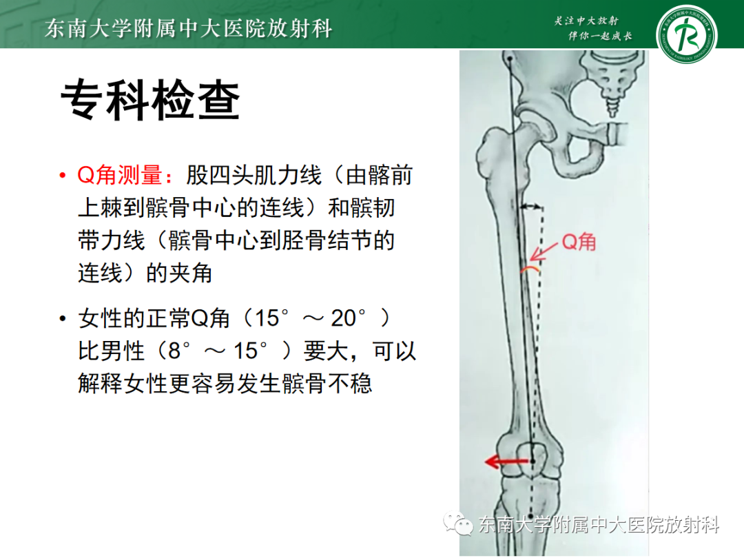影像PPT - 【PPT】髌骨不稳与髌骨脱位影像学评估-7