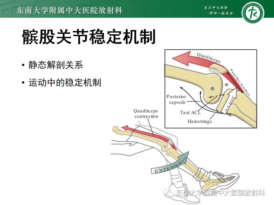 影像PPT - 【PPT】髌骨不稳与髌骨脱位影像学评估-9