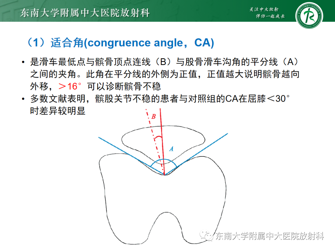 影像PPT - 【PPT】髌骨不稳与髌骨脱位影像学评估-17