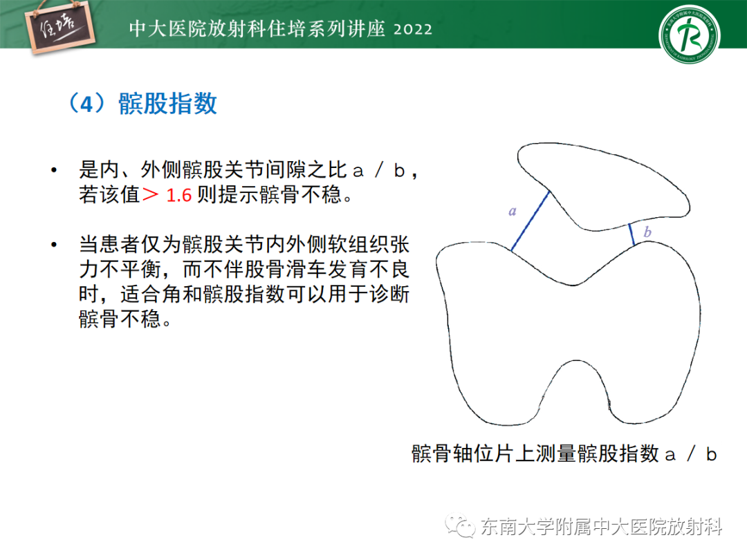 影像PPT - 【PPT】髌骨不稳与髌骨脱位影像学评估-20