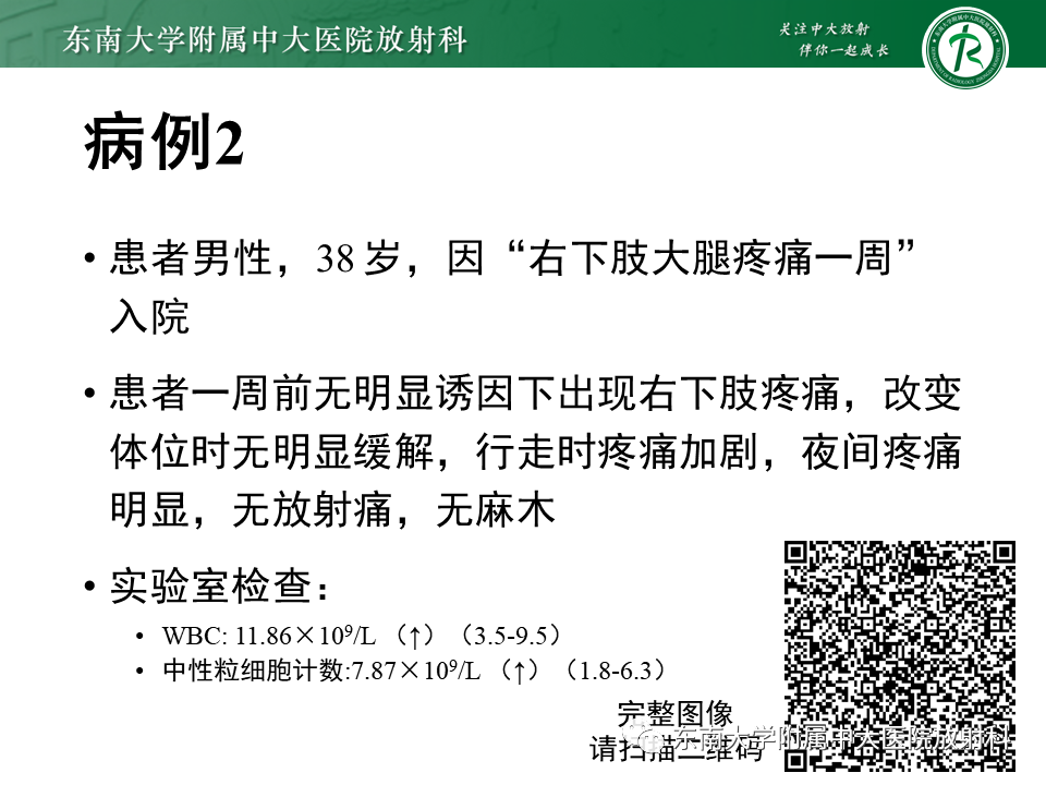 影像PPT - 【PPT】股骨肿瘤（样）病变影像诊断思路-5