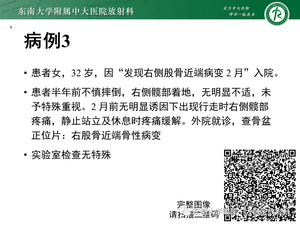 影像PPT - 【PPT】股骨肿瘤（样）病变影像诊断思路-9