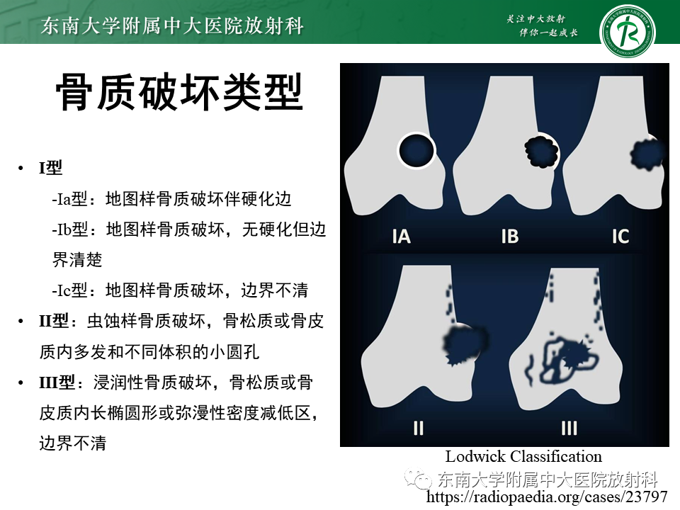 影像PPT - 【PPT】股骨肿瘤（样）病变影像诊断思路-25