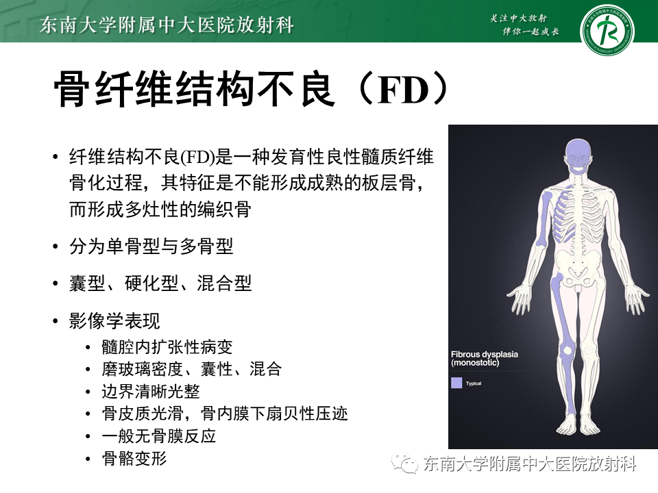 影像PPT - 【PPT】股骨肿瘤（样）病变影像诊断思路-36