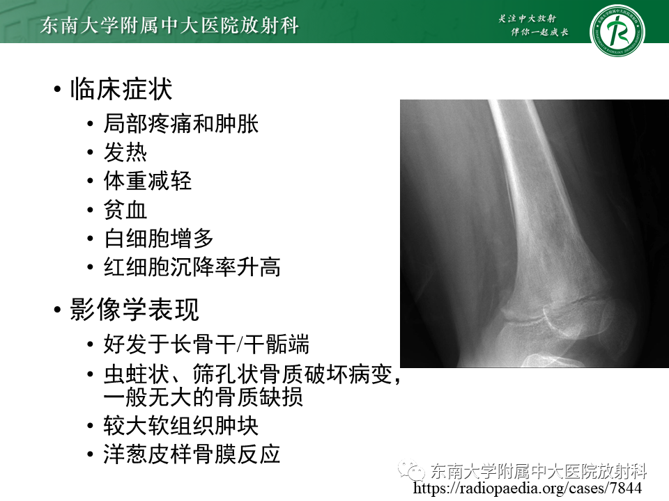 影像PPT - 【PPT】股骨肿瘤（样）病变影像诊断思路-40