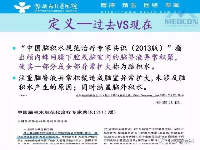 影像PPT - 【PPT】脑积水定义、分类新进展和影像诊断-5