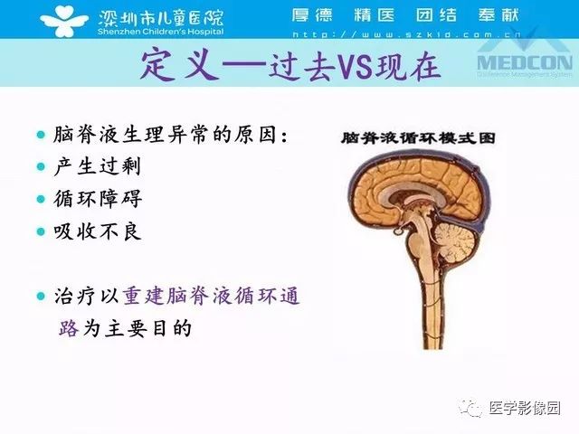 影像PPT - 【PPT】脑积水定义、分类新进展和影像诊断-7