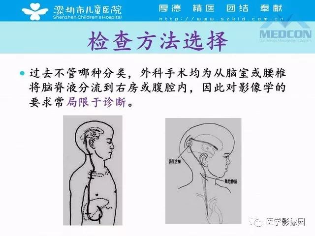 影像PPT - 【PPT】脑积水定义、分类新进展和影像诊断-14
