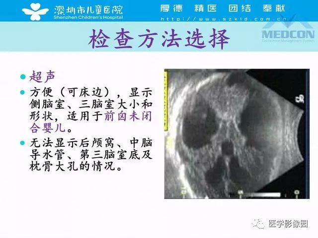 影像PPT - 【PPT】脑积水定义、分类新进展和影像诊断-15