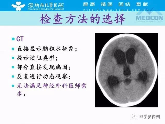 影像PPT - 【PPT】脑积水定义、分类新进展和影像诊断-16