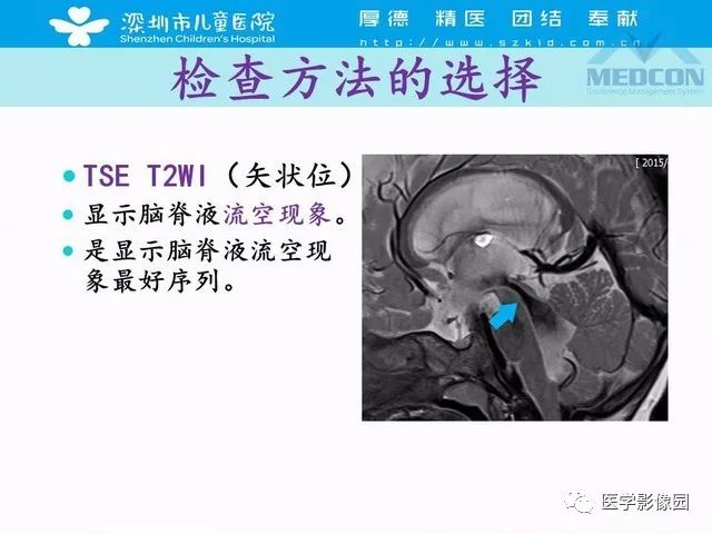 影像PPT - 【PPT】脑积水定义、分类新进展和影像诊断-21