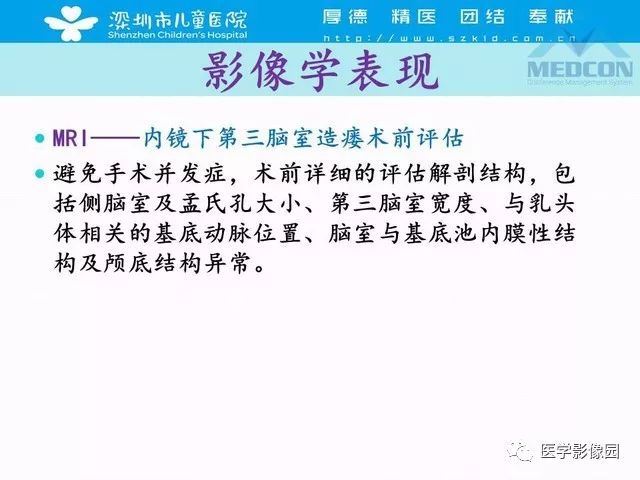 影像PPT - 【PPT】脑积水定义、分类新进展和影像诊断-48