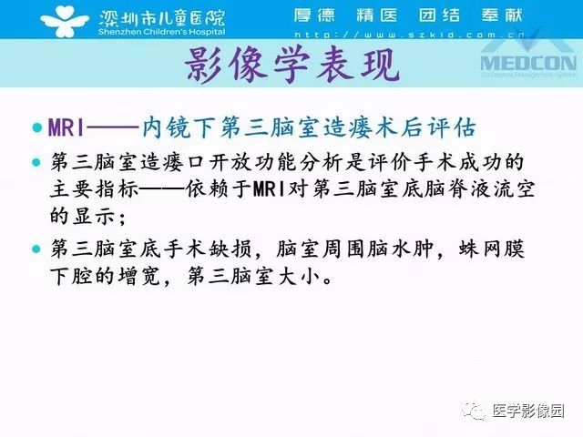 影像PPT - 【PPT】脑积水定义、分类新进展和影像诊断-51
