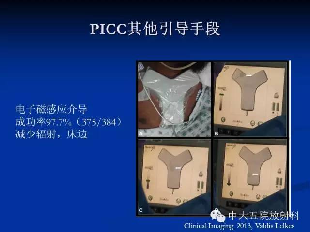 影像PPT - 【PPT】胸部正位片验证PICC-7