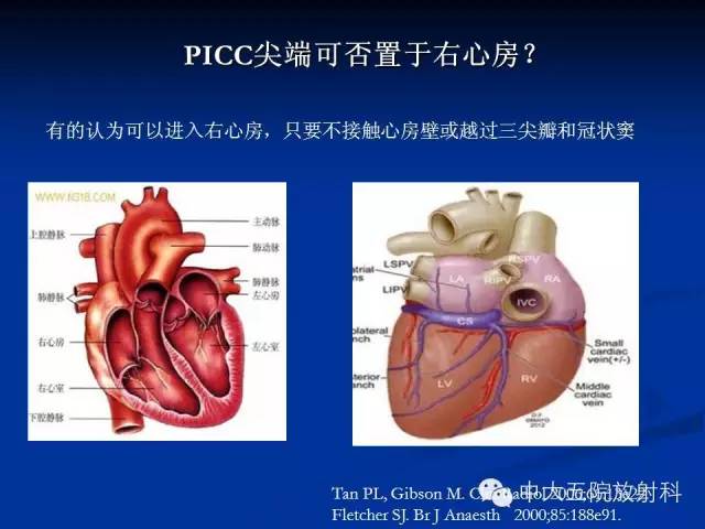 影像PPT - 【PPT】胸部正位片验证PICC-12