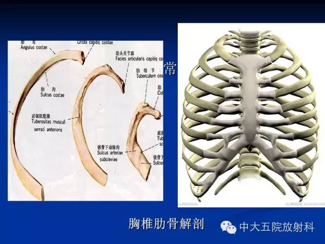 影像PPT - 【PPT】胸部正位片验证PICC-20