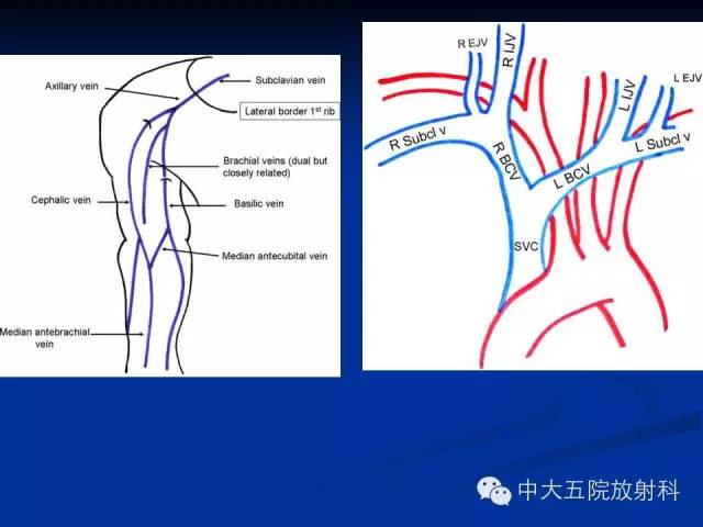影像PPT - 【PPT】胸部正位片验证PICC-35