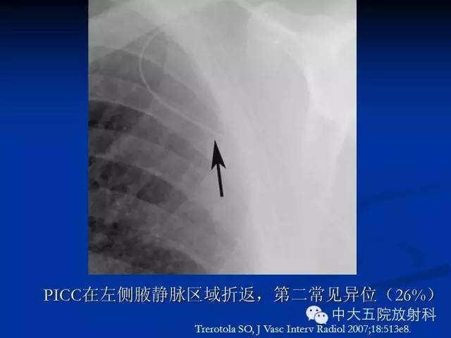 影像PPT - 【PPT】胸部正位片验证PICC-39