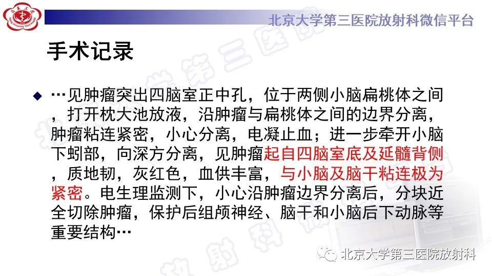 影像PPT - 【PPT】脑干胶质瘤-8