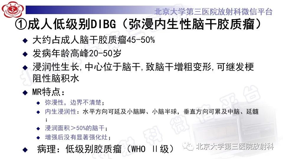 影像PPT - 【PPT】脑干胶质瘤-14