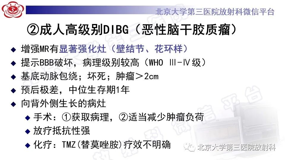 影像PPT - 【PPT】脑干胶质瘤-17