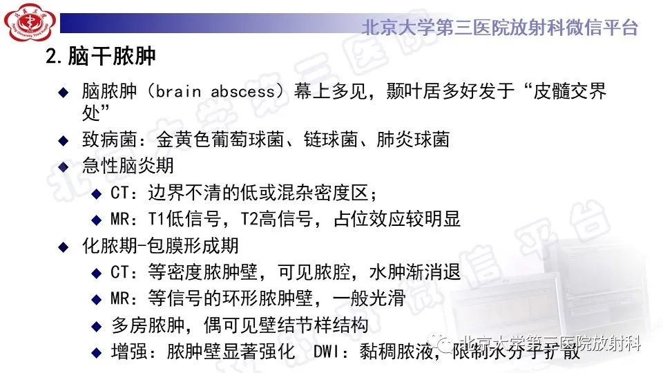 影像PPT - 【PPT】脑干胶质瘤-27