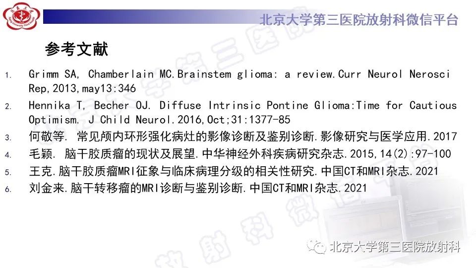 影像PPT - 【PPT】脑干胶质瘤-33