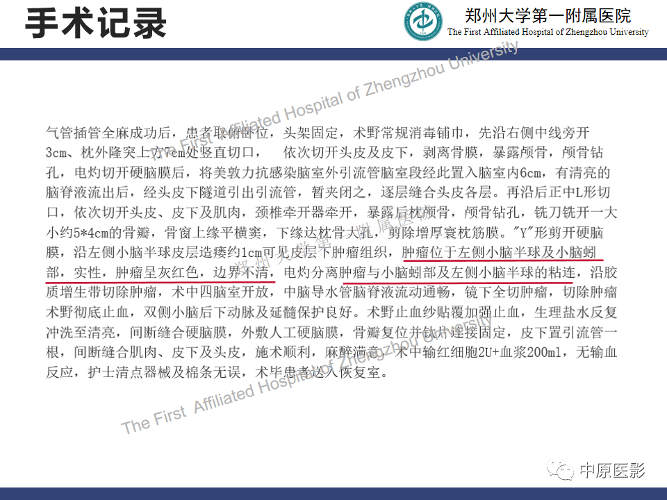 影像PPT - 【病例】小脑多形性黄色瘤性星形细胞瘤1例MR影像-8