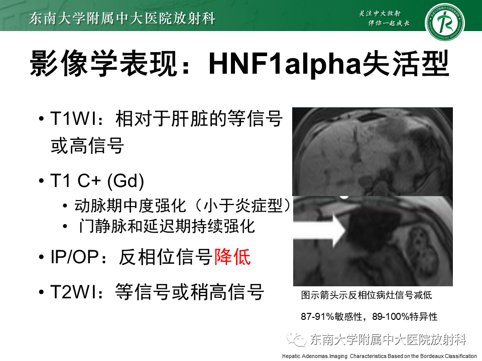 影像PPT - 【PPT】肝细胞腺瘤-23