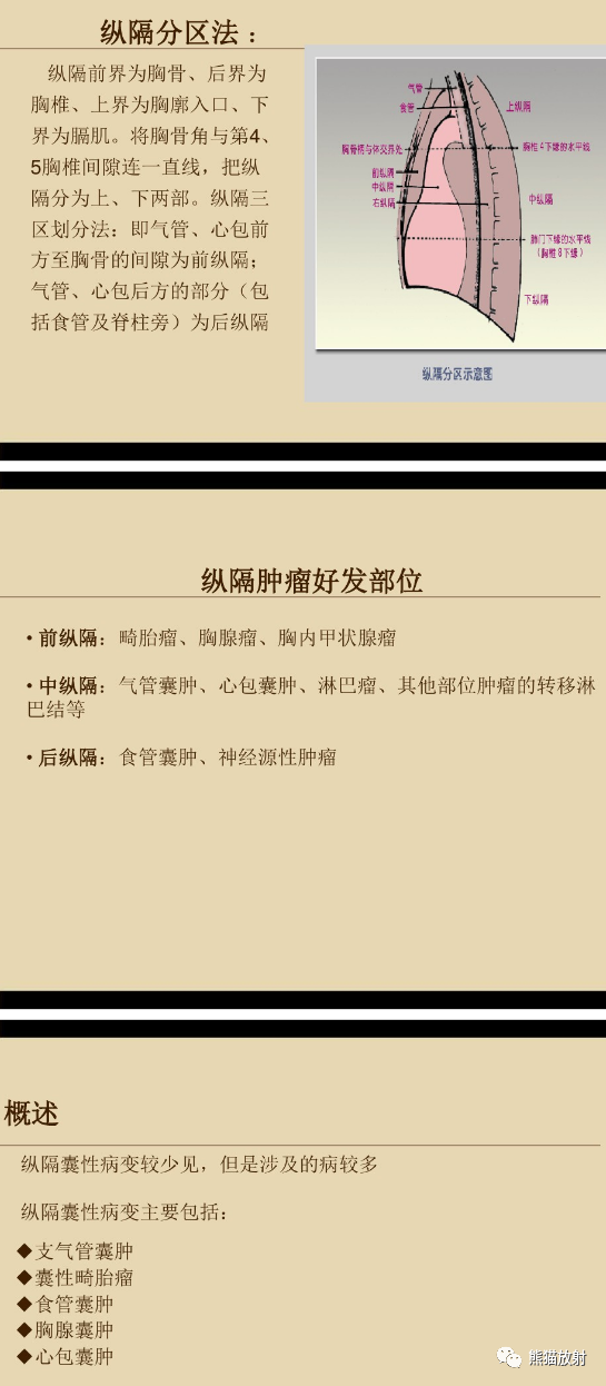 影像PPT - 【病例】纵隔支气管源性囊肿1例CT影像-7