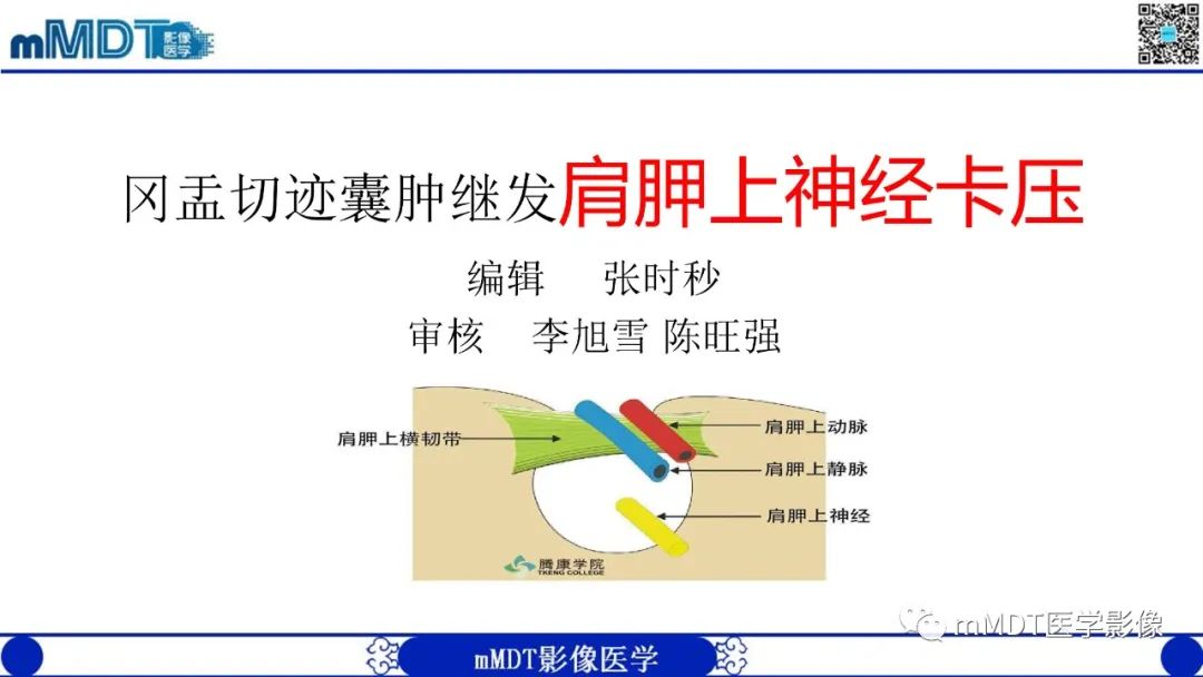 影像PPT - 【PPT】冈盂切迹囊肿继发肩胛上神经卡压-5
