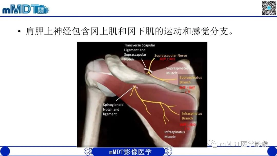 影像PPT - 【PPT】冈盂切迹囊肿继发肩胛上神经卡压-8