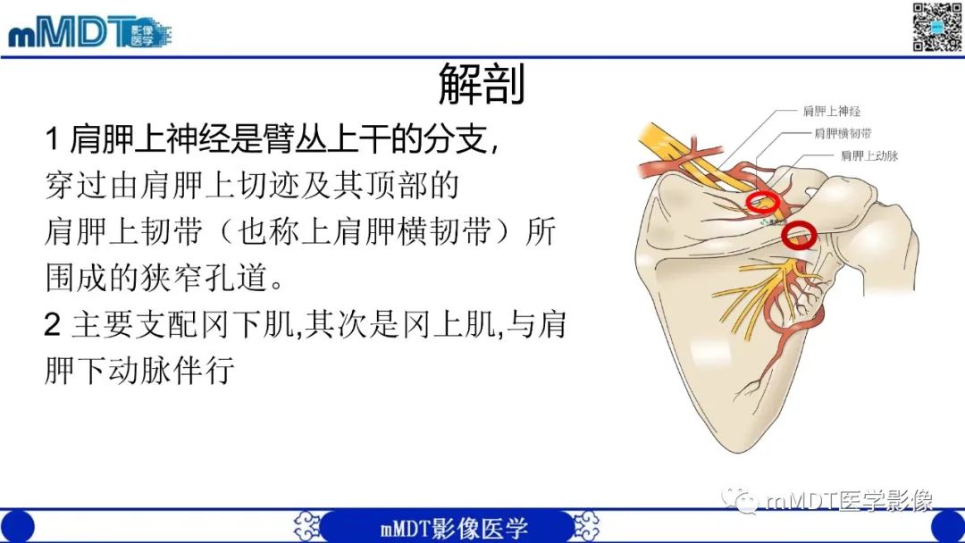 影像PPT - 【PPT】冈盂切迹囊肿继发肩胛上神经卡压-6