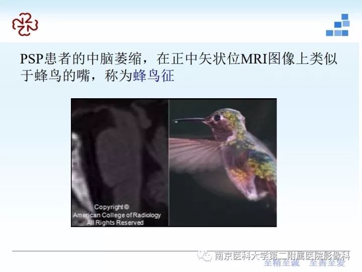 影像PPT - 【PPT】进行性核上性麻痹在MRI上的征象分析-8