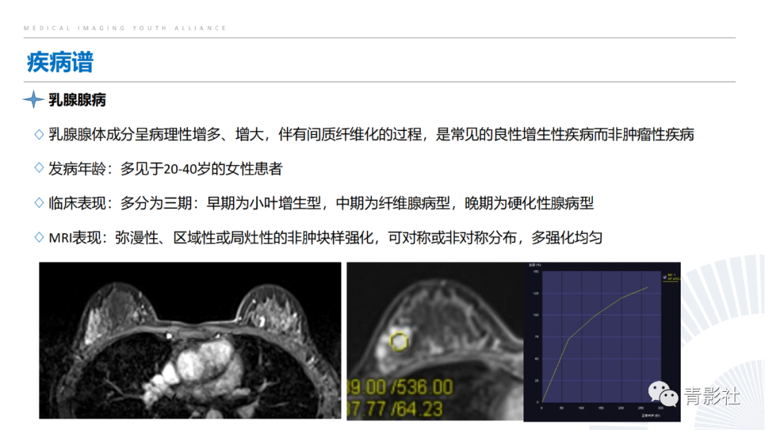 影像PPT - 【PPT】乳腺非肿块样强化病变的影像诊断思路-17