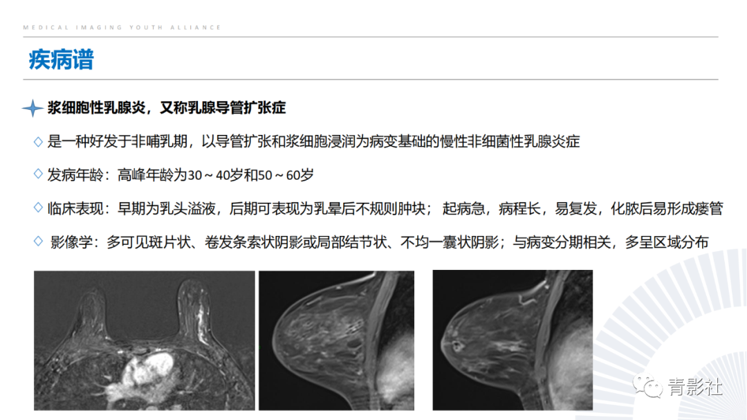 影像PPT - 【PPT】乳腺非肿块样强化病变的影像诊断思路-19