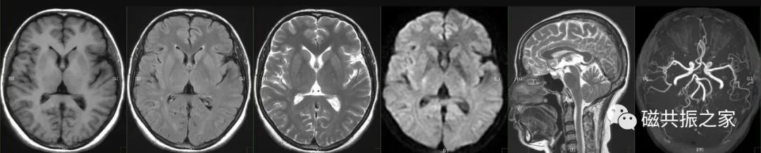 影像PPT - 几分钟就扫完的头颅MRI+MRA,是你想要的吗?-1 影像PPT - 几分钟就扫完的头颅MRI+MRA,是你想要的吗?-1