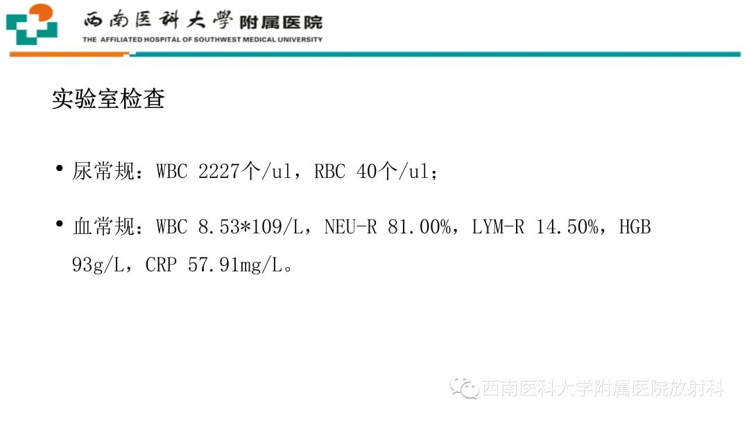 影像PPT - 【PPT】黄色肉芽肿性肾盂肾炎-3