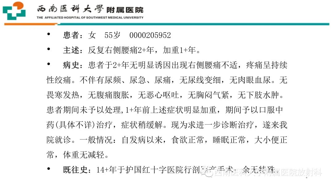 影像PPT - 【PPT】黄色肉芽肿性肾盂肾炎-2